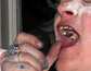 a mouth