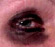 a dark eye
