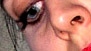 eye with nose
