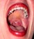 a mouth