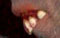 teeth